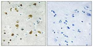 Immunohistochemical analysis of paraffin-embedded human brain using Anti-RPL34 Antibody 1:100 (4°C overnight). The right hand panel represents a negative control, where the antibody was pre-incubated with the immunising peptide