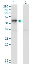 Anti-PAK1 Mouse Monoclonal Antibody [clone: 4D1]