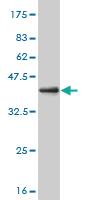 Anti-RCVRN Mouse Monoclonal Antibody [clone: 4D9]