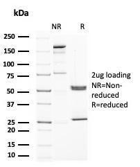 SDS-PAGE analysis of Anti-Uroplakin 1A Antibody [UPK1A/2922] under non-reduced and reduced conditions; showing intact IgG and intact heavy and light chains, respectively. SDS-PAGE analysis confirms the integrity and purity of the antibody