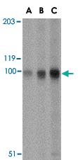 Anti-STIM2 Rabbit Polyclonal Antibody