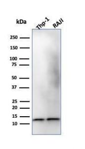 Western blot analysis of THP-1 and Raji Cell lysates using Anti-beta 2 Microglobulin Antibody [B2M/1118]