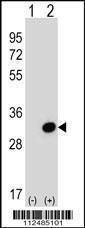 Anti-SCGN Rabbit Polyclonal Antibody (Biotin)