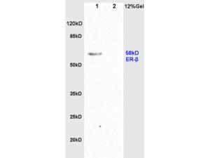 Anti-Estrogen Receptor alpha + beta Rabbit Polyclonal Antibody