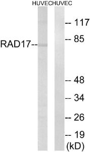 Western blot analysis of lysates from HUVEC cells using Anti-RAD17 Antibody. The right hand lane represents a negative control, where the antibody is blocked by the immunising peptide.