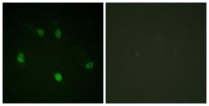 Immunofluorescence analysis of HeLa cells using Anti-Cyclin E1 Antibody. The right hand panel represents a negative control, where the antibody was pre-incubated with the immunising peptide.