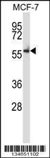 Anti-NLK Rabbit Polyclonal Antibody (APC (Allophycocyanin))