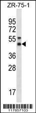 Anti-STX5 Rabbit Polyclonal Antibody (APC (Allophycocyanin))