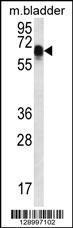 Anti-CCDC102A Rabbit Polyclonal Antibody (PE (Phycoerythrin))