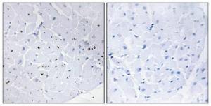 Immunohistochemical analysis of paraffin-embedded human heart tissue using Anti-Cyclin E1 Antibody. The right hand panel represents a negative control, where the antibody was pre-incubated with the immunising peptide.