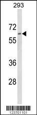 Anti-DOLK Rabbit Polyclonal Antibody (Biotin)