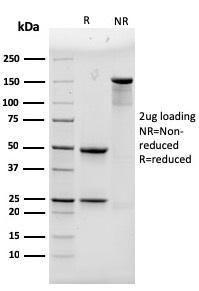 SDS-PAGE analysis of Anti-alpha Actinin 4 Antibody [93] under non-reduced and reduced conditions; showing intact IgG and intact heavy and light chains, respectively. SDS-PAGE analysis confirms the integrity and purity of the antibody.