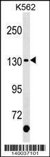 Anti-KIT Rabbit Polyclonal Antibody