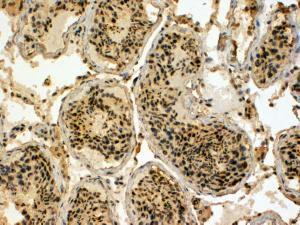 Anti-UBR5 Antibody (A83919) (4 µg/ml) staining of paraffin embedded Human Testis. Steamed antigen retrieval with Tris/EDTA buffer pH 9, HRP-staining. These results could not be obtained after antigen retrieval at pH6