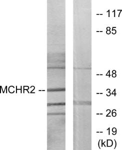 Western blot analysis of lysates from HUVEC cells using Anti-MCHR2 Antibody. The right hand lane represents a negative control, where the antibody is blocked by the immunising peptide