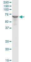 Anti-HSPD1 Rabbit Polyclonal Antibody