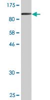 Anti-LIMA1 Mouse Monoclonal Antibody [clone: 1B7]