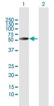 Anti-HSPD1 Rabbit Polyclonal Antibody