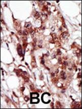 Anti-BRD4 Rabbit Polyclonal Antibody