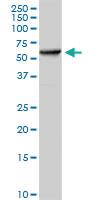 Anti-HSPD1 Rabbit Polyclonal Antibody