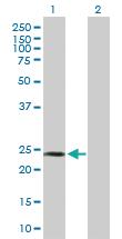 Anti-SPA17 Mouse Polyclonal Antibody