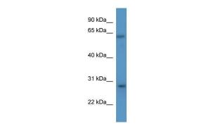 Anti-CISH Rabbit Polyclonal Antibody