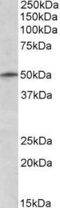 Anti-TRIM35 Antibody (A83921) (1µg/ml) staining of K562 lysate (35µg protein in RIPA buffer). Primary incubation was 1 hour. Detected by chemiluminescence.