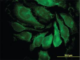 Anti-PAK1 Mouse Monoclonal Antibody [clone: 4D1]