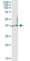 Anti-TLX3 Polyclonal Antibody Pair