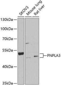 Western blot analysis of extracts of various cell lines, using Anti-PNPLA3 Antibody (A9972) at 1:1,000 dilution The secondary antibody was Goat Anti-Rabbit IgG H&L Antibody (HRP) at 1:10,000 dilution Lysates/proteins were present at 25 µg per lane