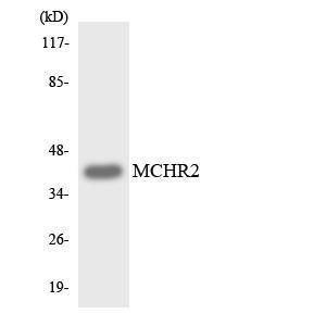 Western blot analysis of the lysates from HeLa cells using Anti-MCHR2 Antibody