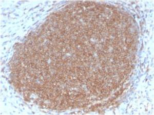 Immunohistochemical analysis of formalin-fixed, paraffin-embedded human lymph node using Anti-CD45RB Antibody [PTPRC/2877R]