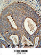 Anti-POTEB Rabbit Polyclonal Antibody (Biotin)