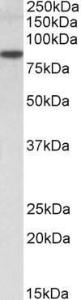 Anti-TRIM36 Antibody (A83922) (2µg/ml) staining of Human Amygdala lysate (35µg protein in RIPA buffer). Primary incubation was 1 hour. Detected by chemiluminescence.