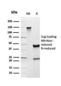 SDS-PAGE analysis of Anti-Inhibin alpha Antibody [INHA/4265] under non-reduced and reduced conditions; showing intact IgG and intact heavy and light chains, respectively. SDS-PAGE analysis confirms the integrity and purity of the Antibody