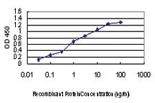 Anti-PAK1 Mouse Monoclonal Antibody [clone: 4D1]