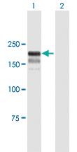 Anti-SLX4 (SLX4 structure-specific endonuclease Subunit) Mouse Polyclonal Antibody