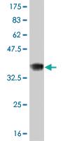 Anti-RCVRN Mouse Monoclonal Antibody [clone: 4C10]