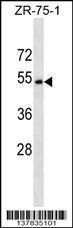 Anti-CCDC112 Rabbit Polyclonal Antibody (APC (Allophycocyanin))