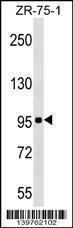 Anti-KIT Rabbit Polyclonal Antibody (AP (Alkaline Phosphatase))