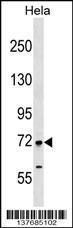 Anti-FIGNL1 Rabbit Polyclonal Antibody (FITC (Fluorescein Isothiocyanate))