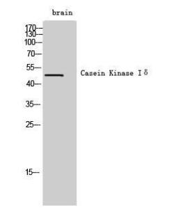 Western blot analysis of brain cells using Anti-CSNK1D Antibody