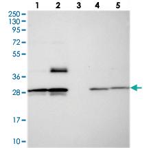 Anti-MXRA7 Rabbit Polyclonal Antibody