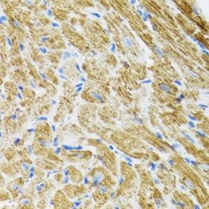 Immunohistochemistry analysis of paraffin-embedded rat heart using Anti-POLG2 Antibody (A9973) at a dilution of 1:100 (40x lens). Perform microwave antigen retrieval with 10 mM PBS buffer pH 7.2 before commencing with IHC staining protocol.