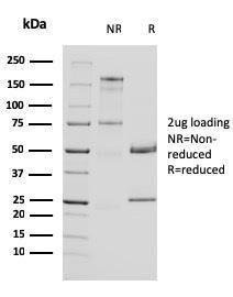 Anti-Uroplakin 1A antibody