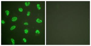 Immunofluorescence analysis of HeLa cells using Anti-DNA-PK Antibody. The right hand panel represents a negative control, where the Antibody was pre-incubated with the immunising peptide