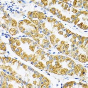 Immunohistochemistry analysis of paraffin-embedded human stomach using Anti-POLG2 Antibody (A9973) at a dilution of 1:100 (40x lens). Perform microwave antigen retrieval with 10 mM PBS buffer pH 7.2 before commencing with IHC staining protocol.