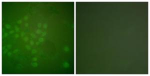 Immunofluorescence analysis of A549 cells using Anti-RAD17 Antibody. The right hand panel represents a negative control, where the antibody was pre-incubated with the immunising peptide.