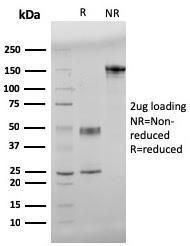 SDS-PAGE analysis of Anti-beta Amyloid Antibody [APP/3345] under non-reduced and reduced conditions; showing intact IgG and intact heavy and light chains, respectively. SDS-PAGE analysis confirms the integrity and purity of the Antibody