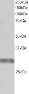 Anti-TRIM7 antibody